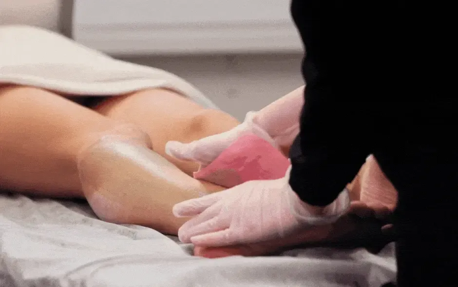 Top Tips to Treat and Prevent Ingrown Hair After Wax